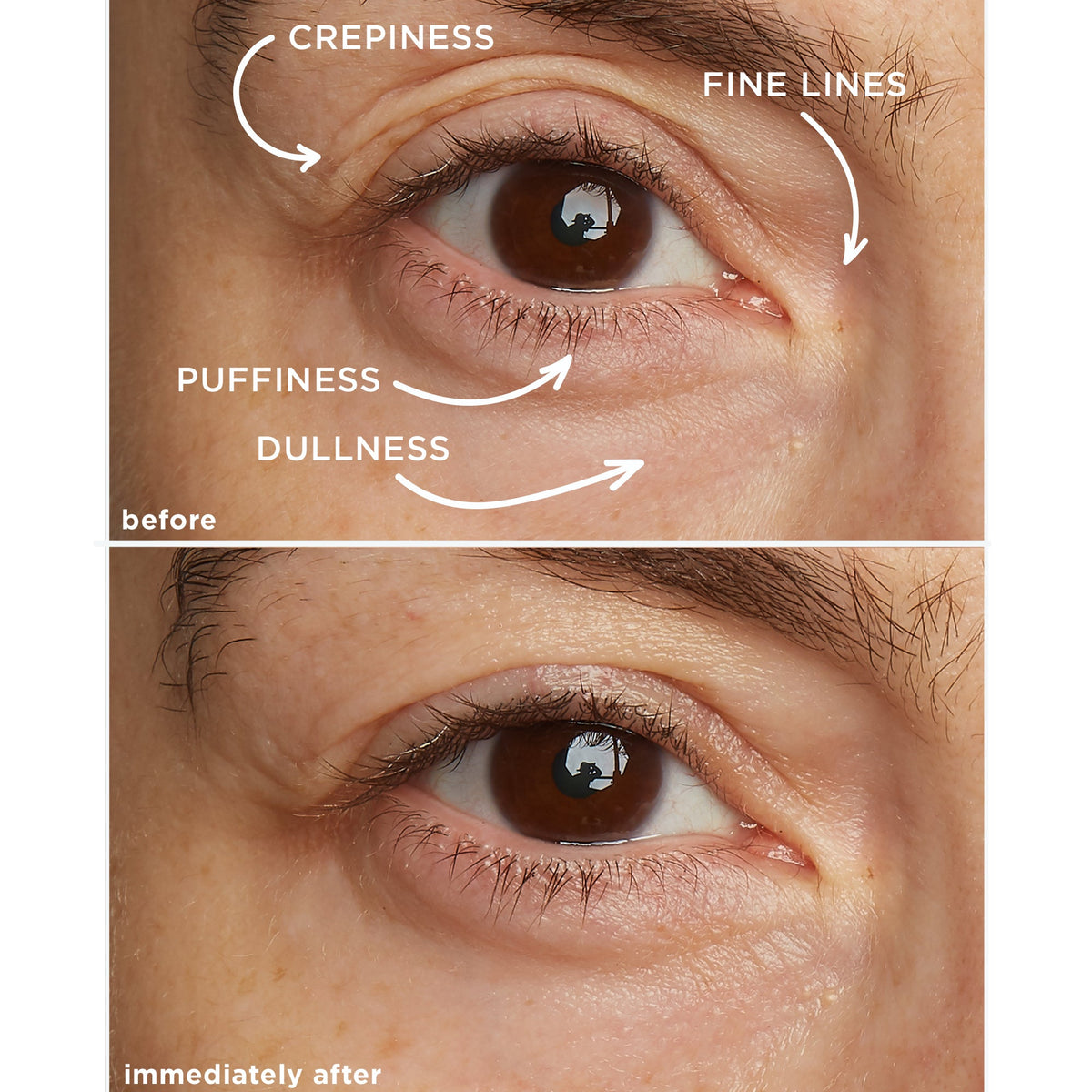 Eye Contour Lifting Cream With Diamond Powder