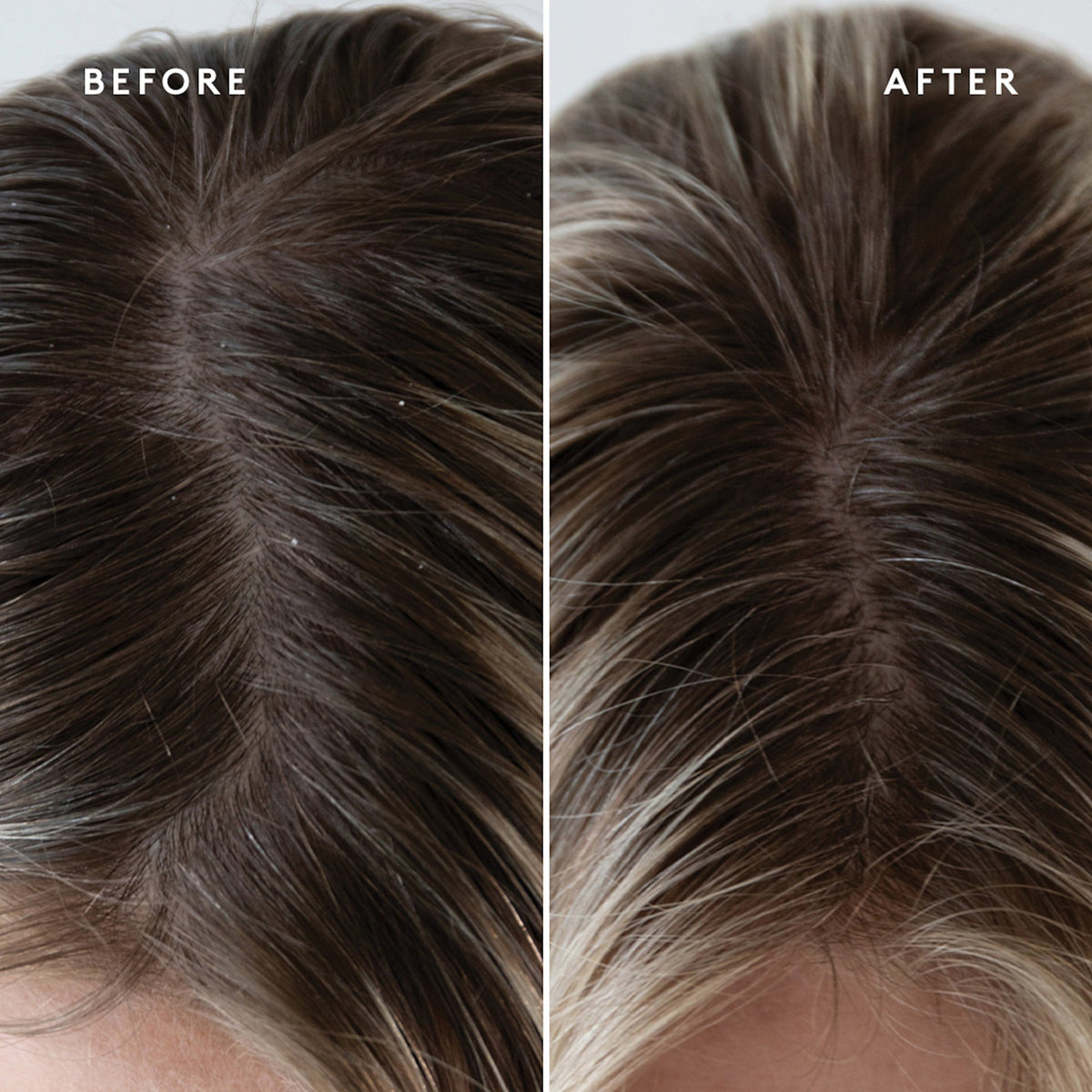 Exfoliating Scalp Treatment