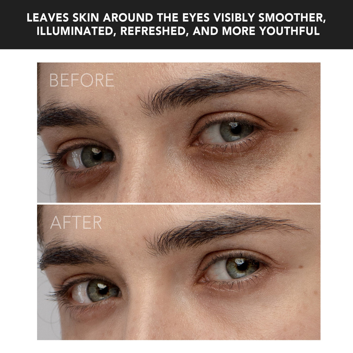 Iris Eye Massager