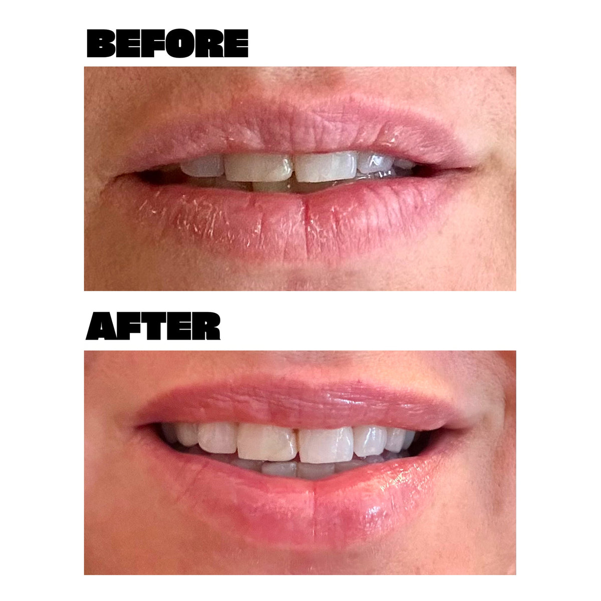 Lip Mask