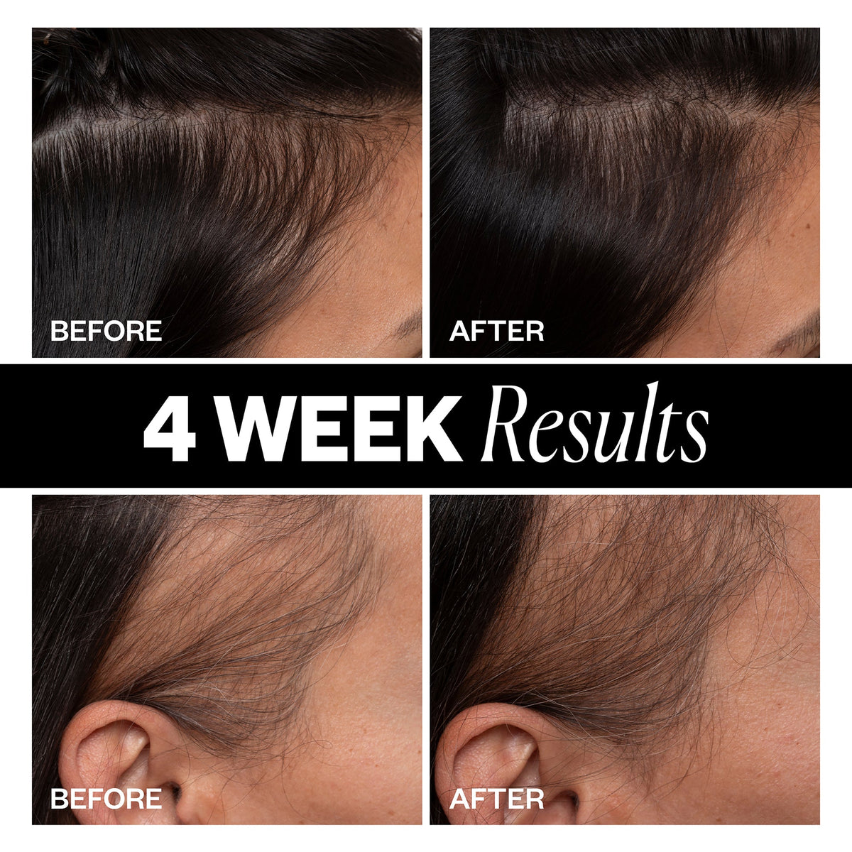 Sponsored High Density Scalp Treatment