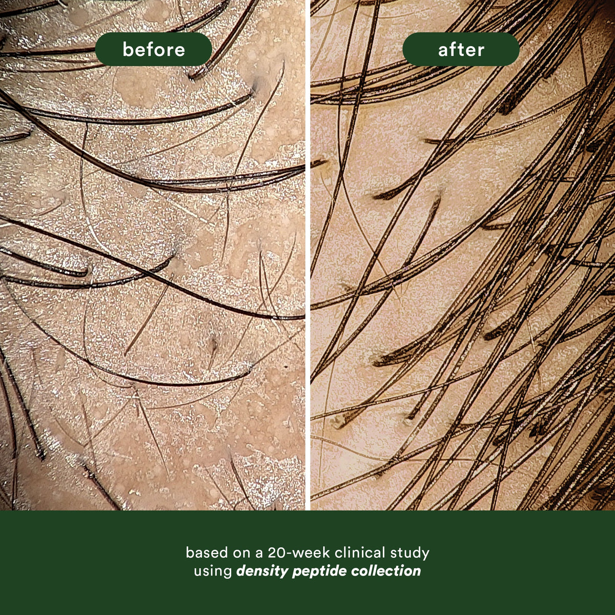 Hair Density Peptide Serum