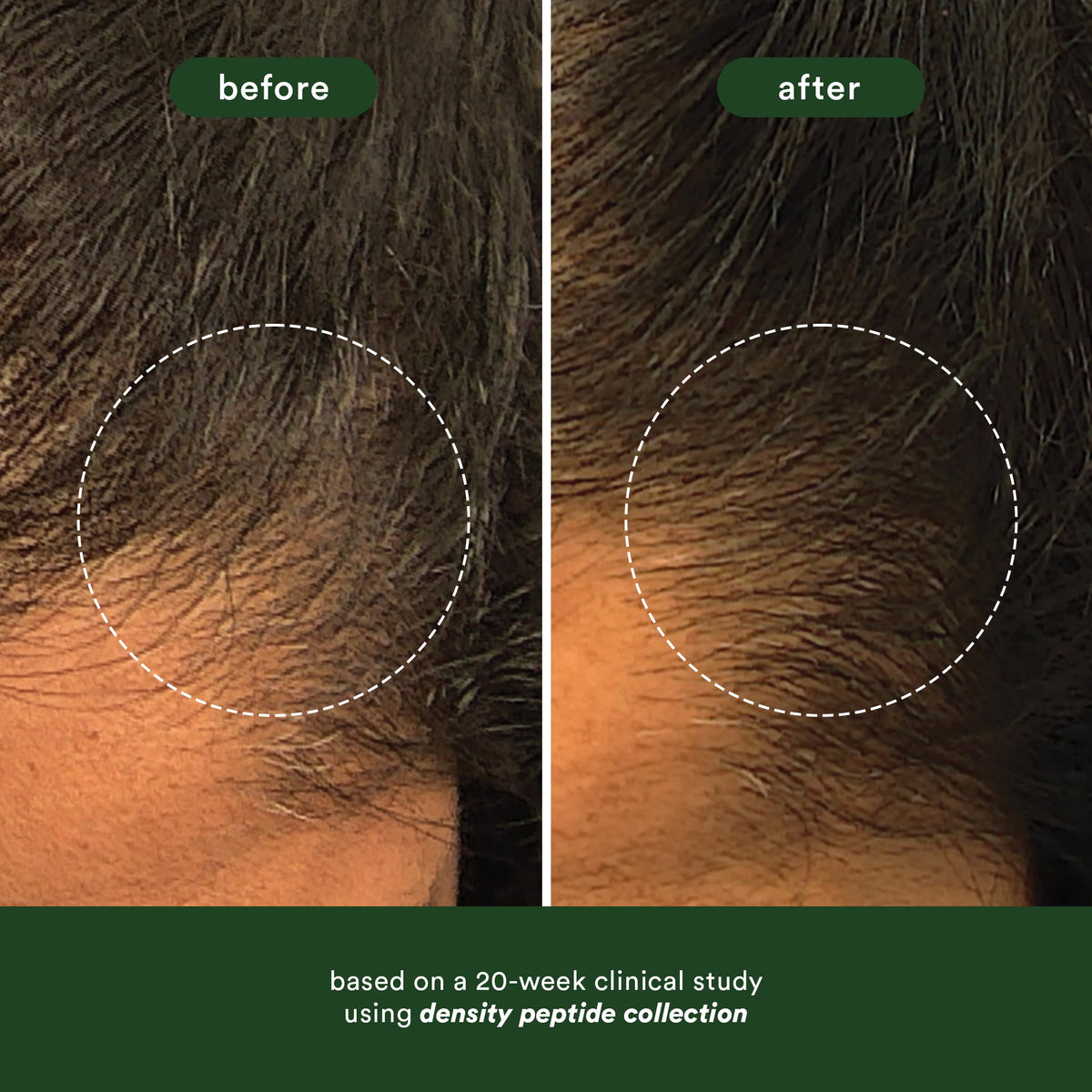 Hair Density Peptide Serum
