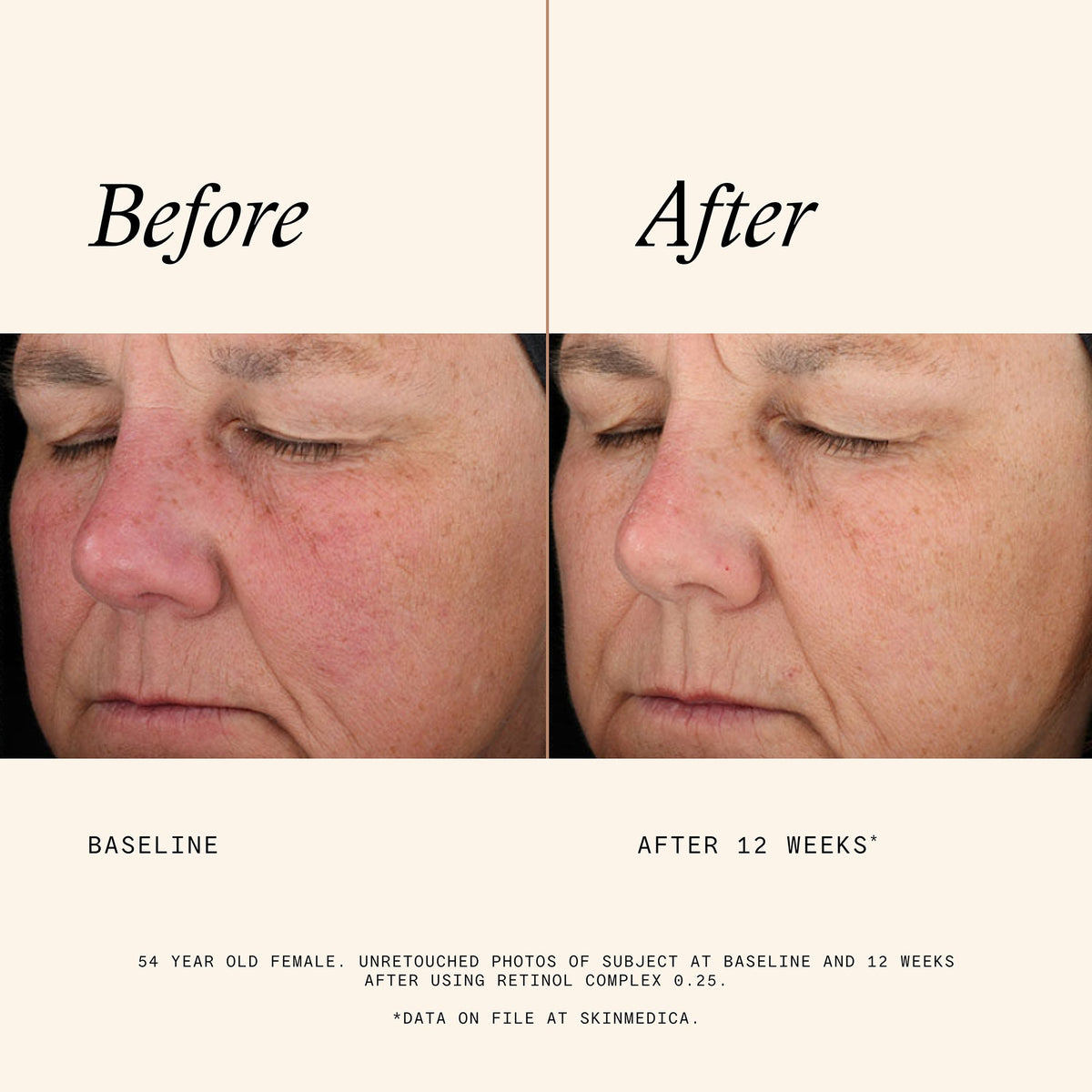 Retinol Complex 0.25