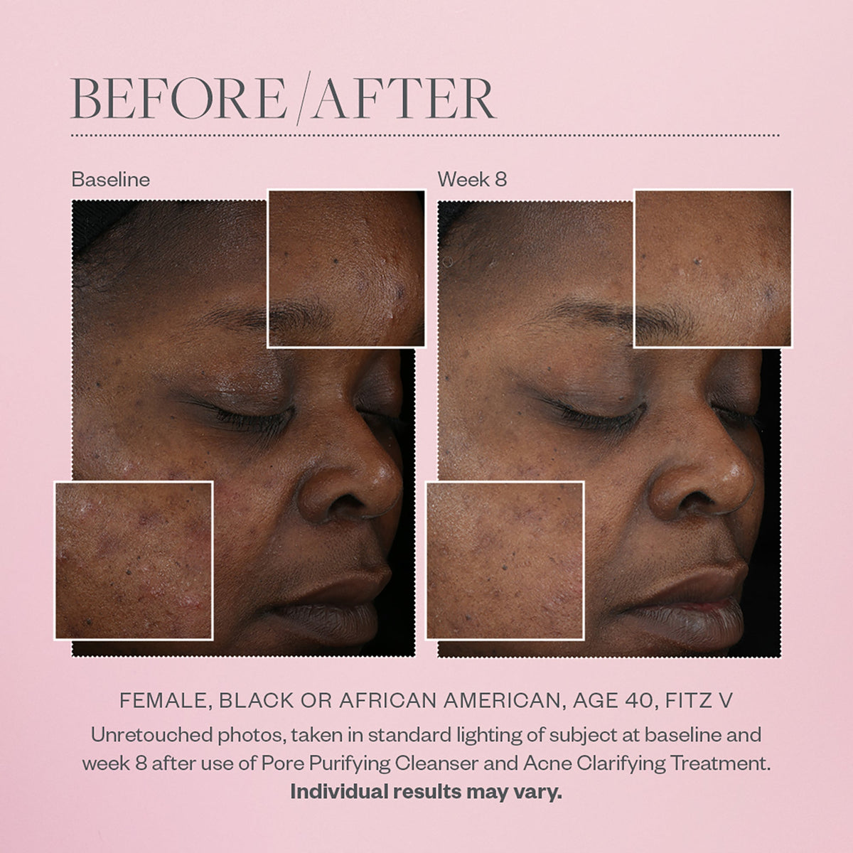 Pore Purifying Gel Cleanser