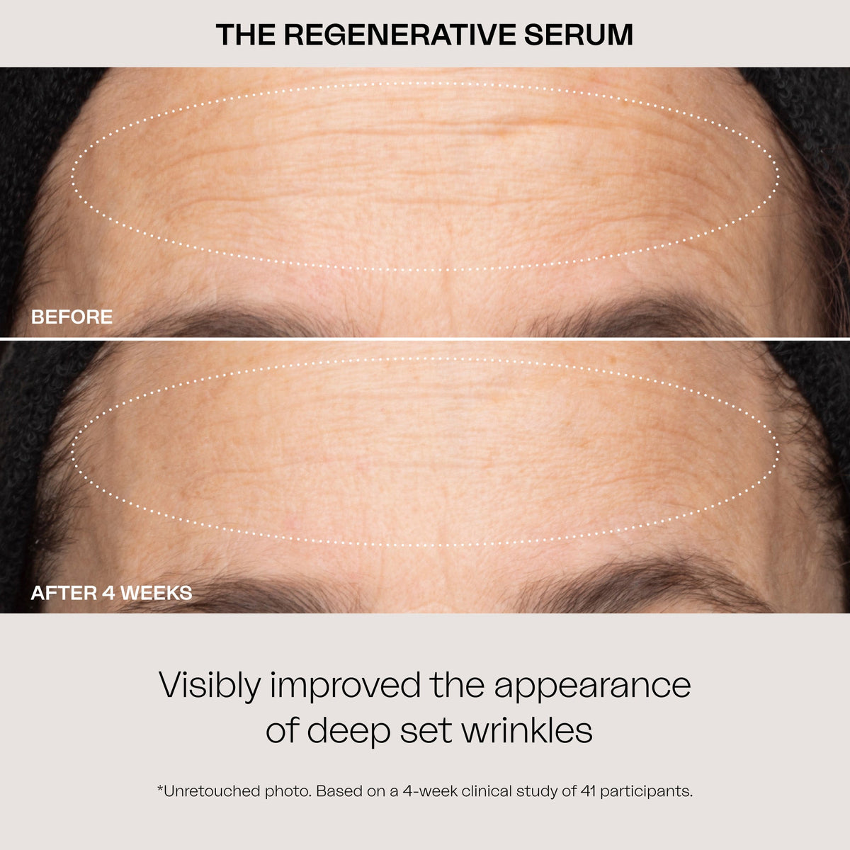 The Regenerative Serum XL