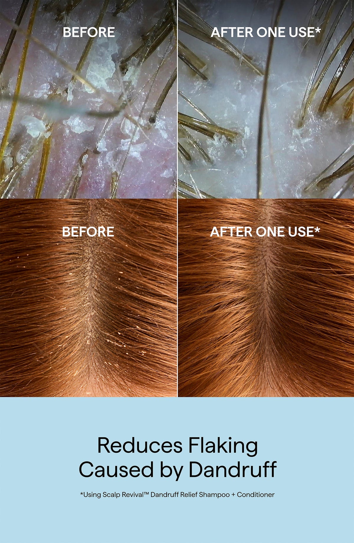 Scalp Revival Dandruff Relief Conditioner