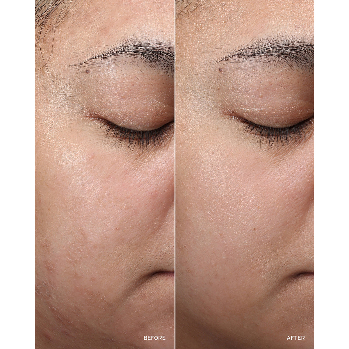 NAD+ Cell Restoration Cream