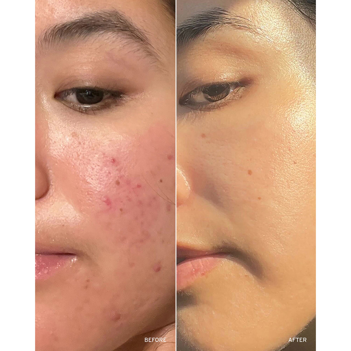 Retinol Peptide Boosting Serum